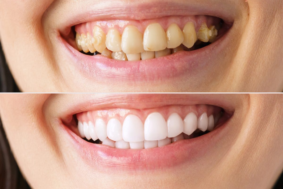 Dental services at SaluVista
